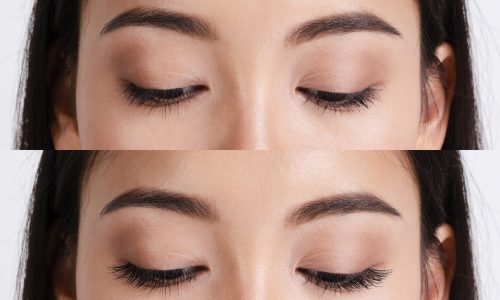 woman-before-after-eyelashes-extensions